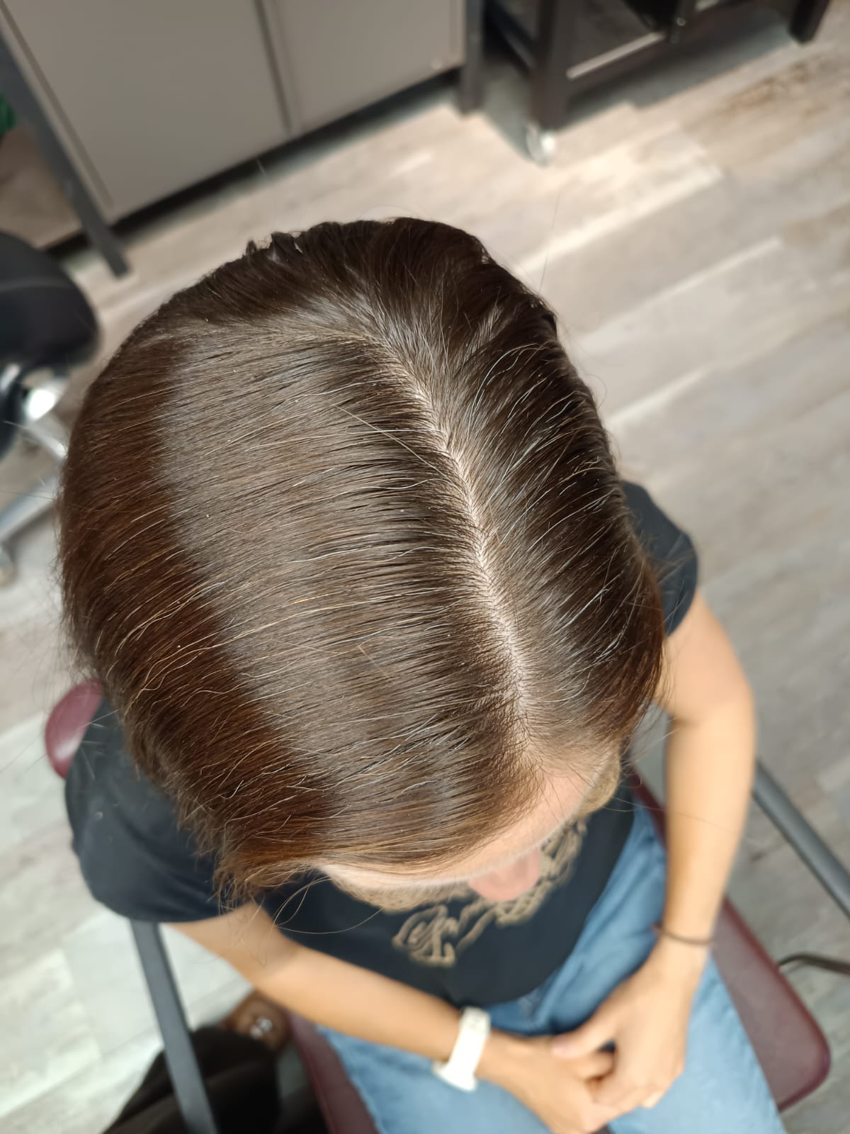 Vorher: braunes Haar mit einzelnen weißen Haaren entlang des Scheitels, von oben fotografiert.